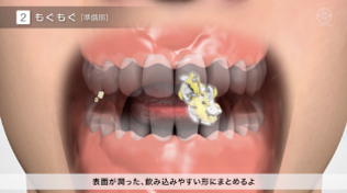 CGイメージ